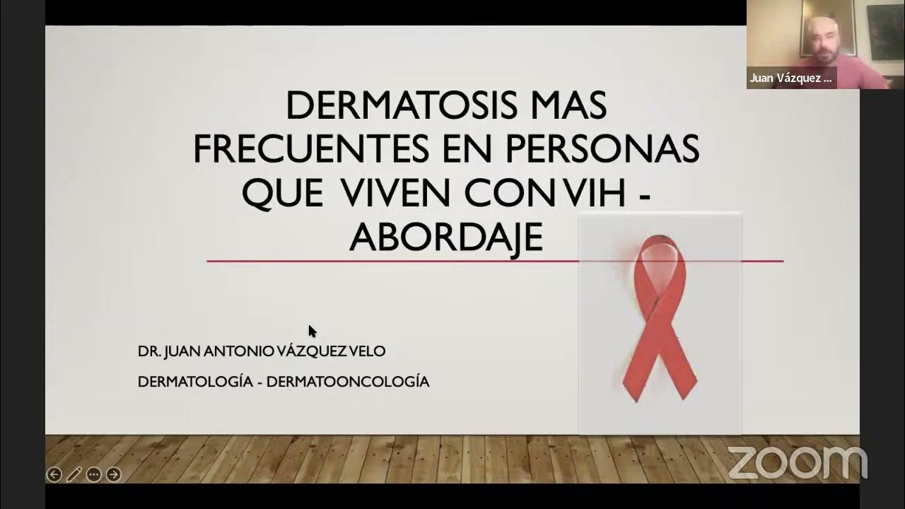 Abordaje inicial de los padecimientos dermatológicos más frecuentes en personas que viven con VIH, por el Dr. Juan Antonio Vázquez, Dermatólogo y Dermatooncólogo.